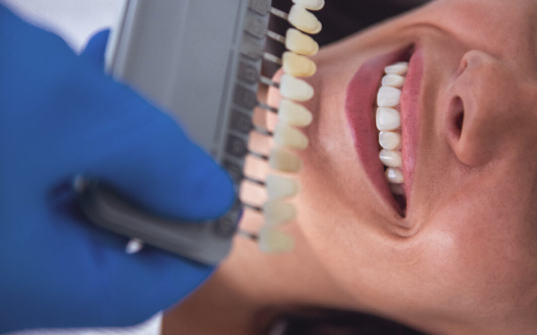 Top Cosmetic Dental Procedures to Enhance Your Smile in 2025