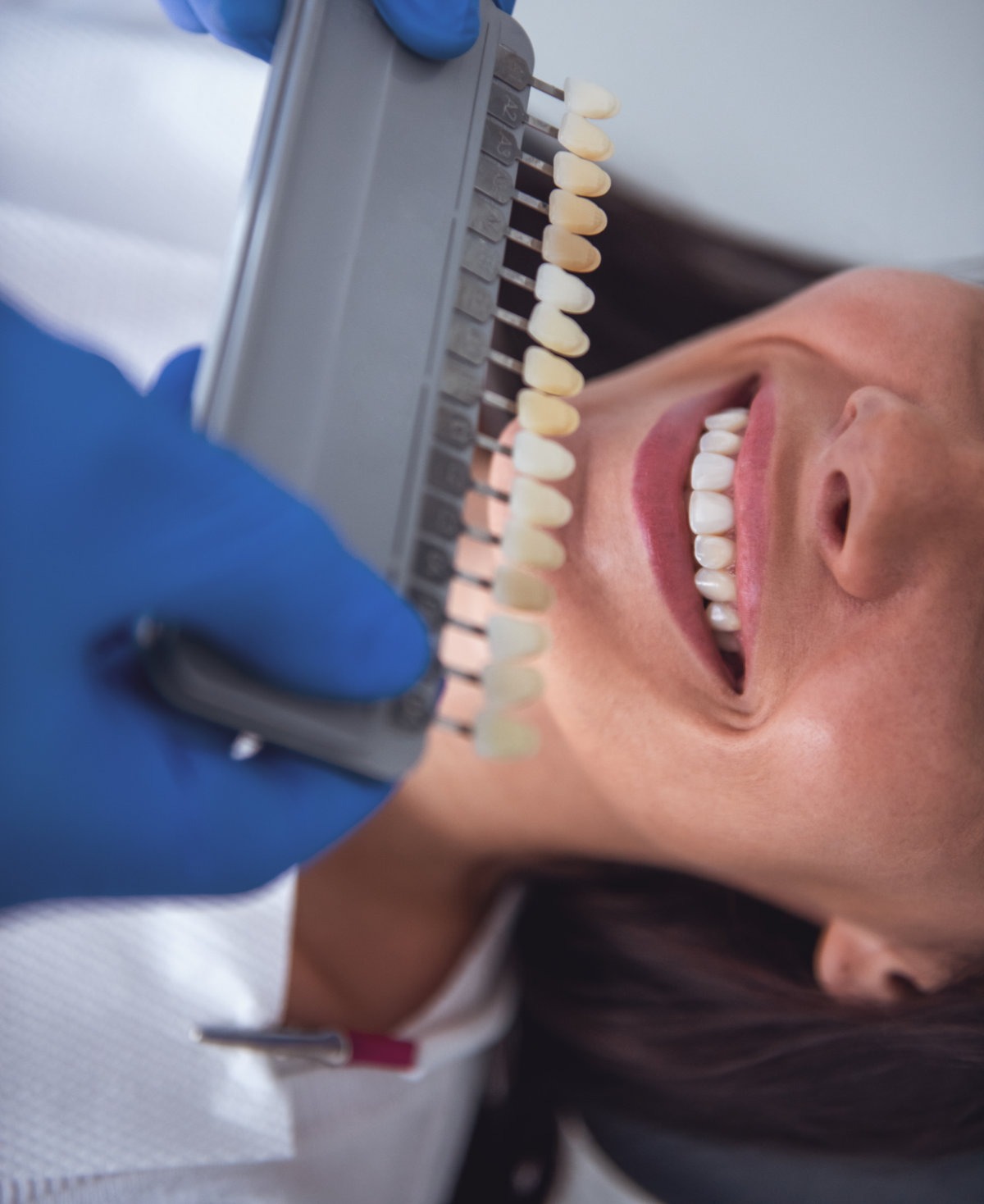 cosmetic dentist in houston
