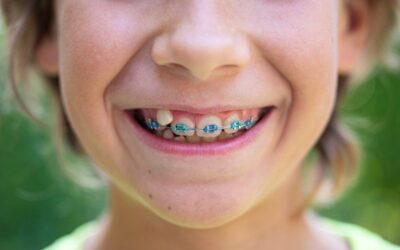 5 Reasons Parents Choose Orthodontic Treatment for Kids Along with Dental Implants Houston, TX Services