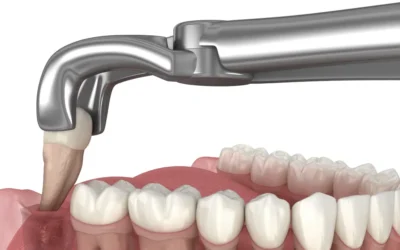 Understanding Outpatient Oral Surgery Wisdom Teeth Procedures and Recovery